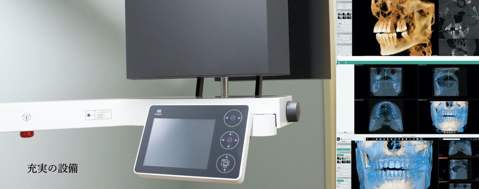 歯科用CTと診断画像
