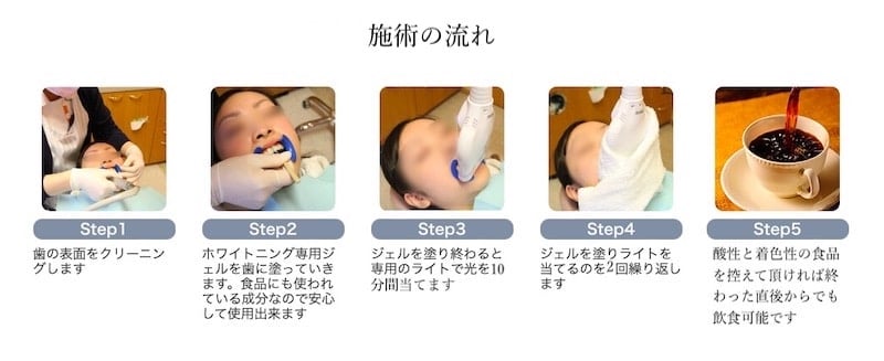 スーパーポリリンホワイトニング